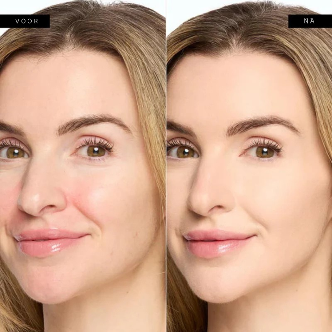 RevitaClay | Verbergt donkere kringen, pigmentvlekken en hoeveelheden | 1+1 gratis